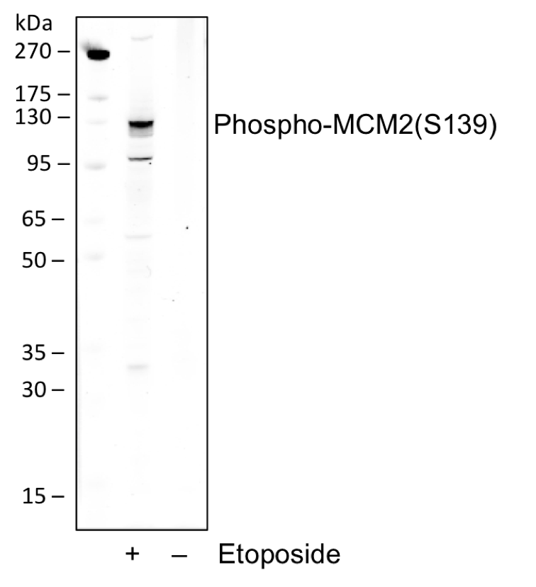 Phospho-MCM2 (Ser139) rabbit mAb Antibody