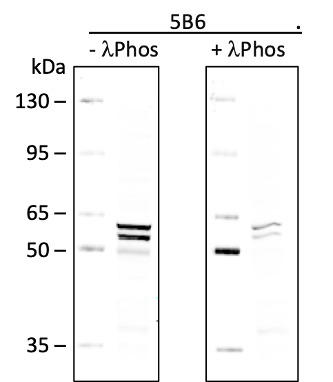 Phospho-Lyn (Tyr507) rabbit mAb Antibody