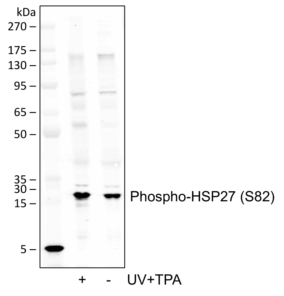 Phospho-HSP27 (Ser82) rabbit mAb Antibody