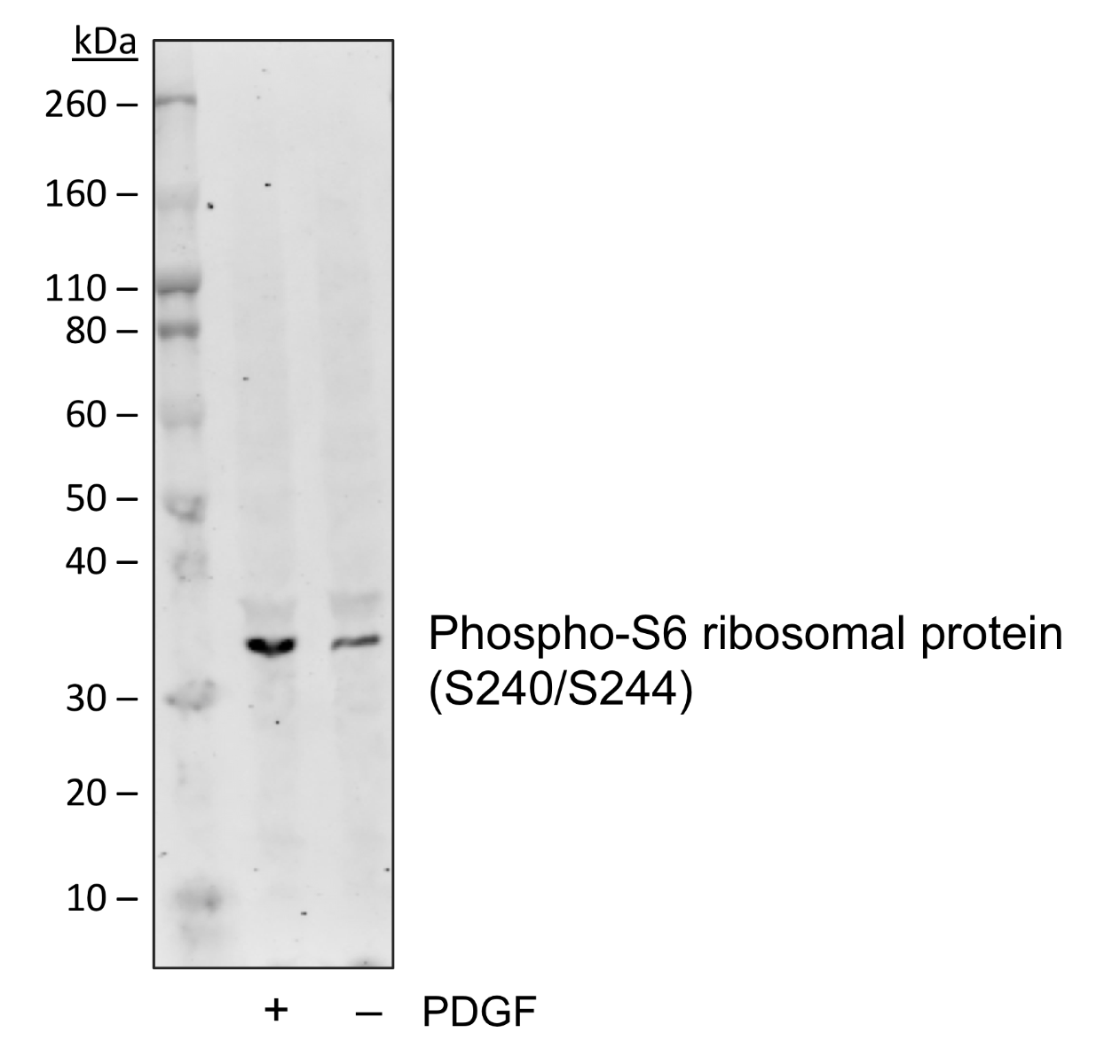 Phospho-S6-Ribosomal Protein (Ser240/244) rabbit mAb Antibody