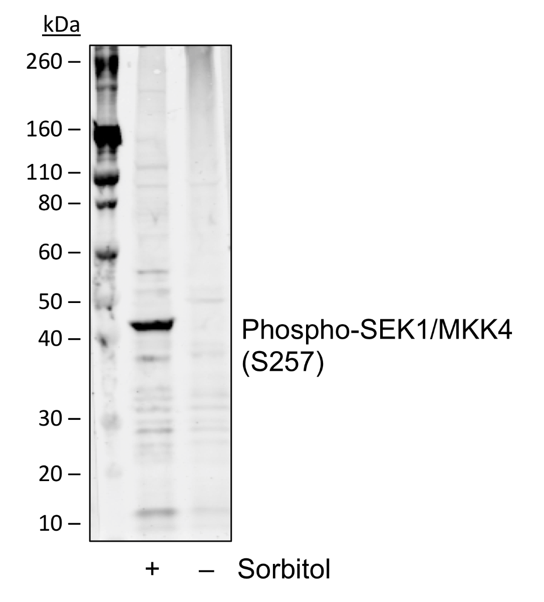 Phospho-SEK1/MKK4 (Ser257) rabbit mAb Antibody