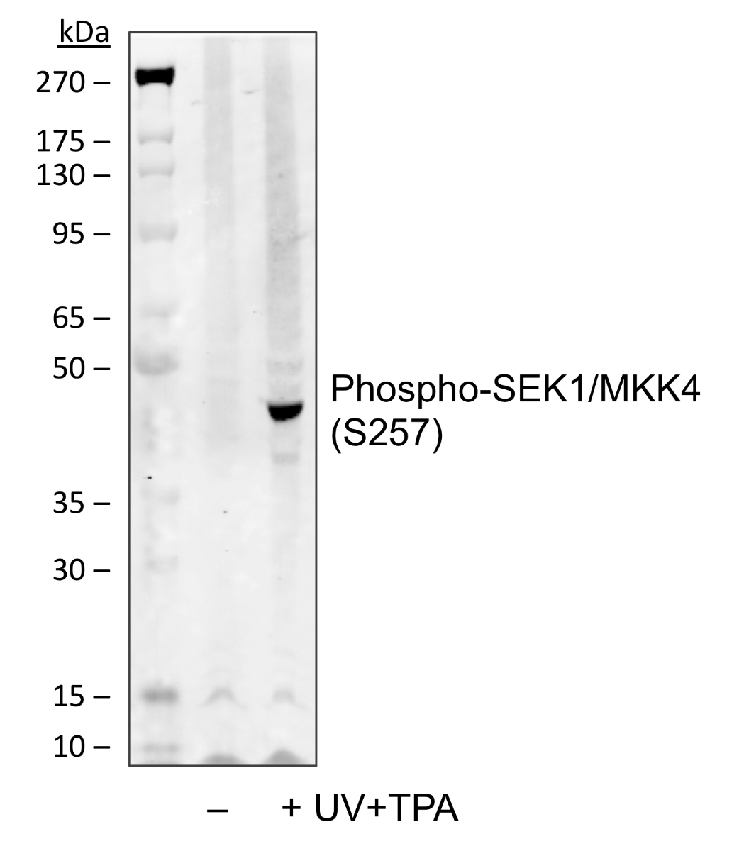 Phospho-SEK1/MKK4 (Ser257) rabbit mAb Antibody