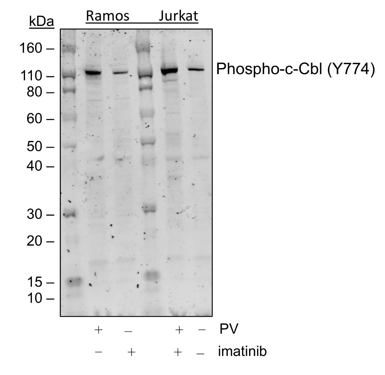 Phospho-c-Cbl (Tyr774) rabbit mAb Antibody