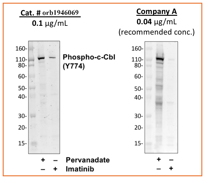 Phospho-c-Cbl (Tyr774) rabbit mAb Antibody