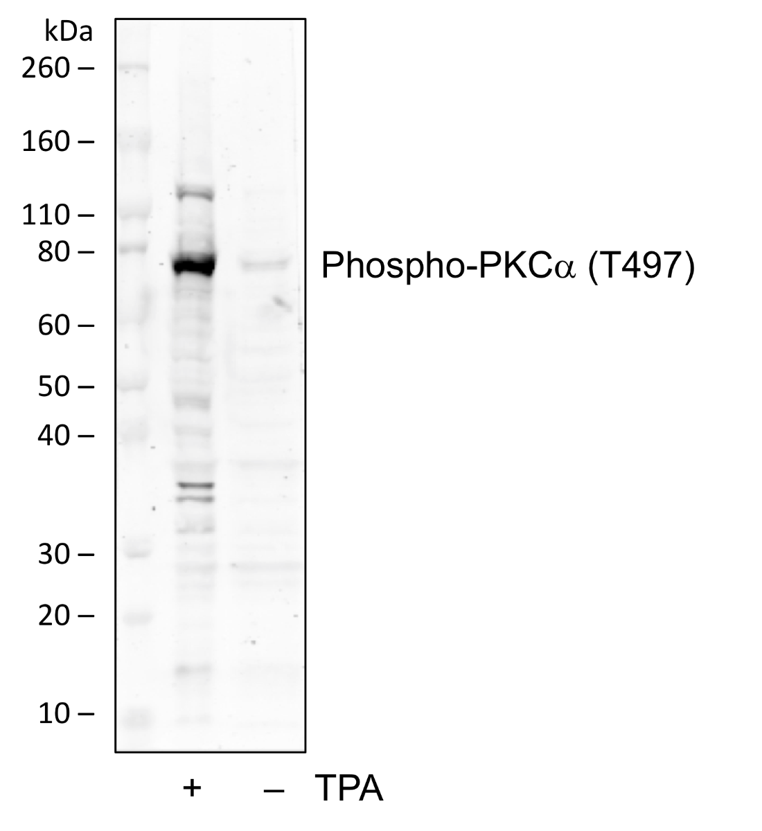 Phospho-PKCa (Thr497) rabbit mAb Antibody