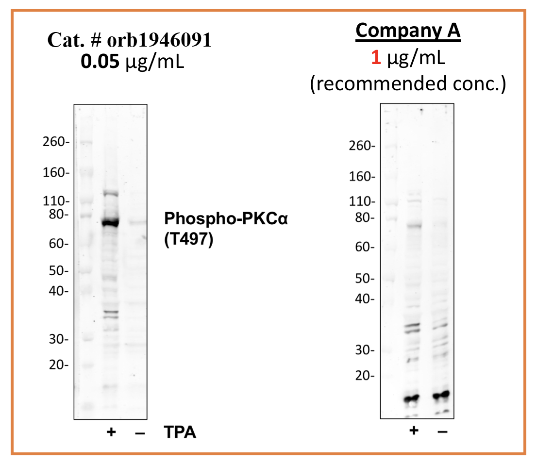 Phospho-PKCa (Thr497) rabbit mAb Antibody
