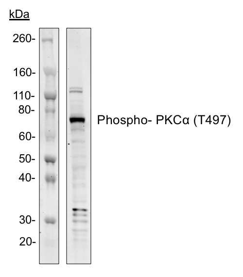 Phospho-PKCa (Thr497) rabbit mAb Antibody