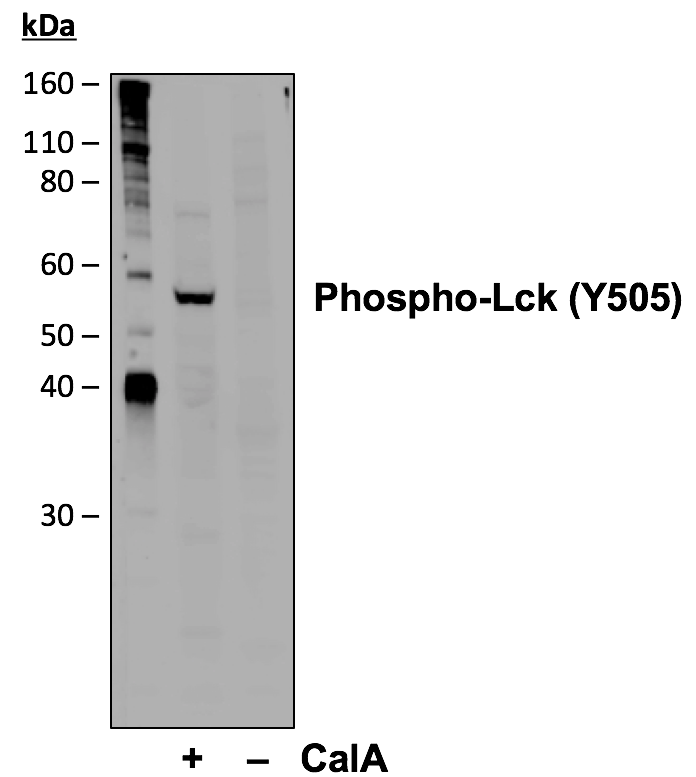Phospho-Lck (Tyr505) rabbit mAb Antibody