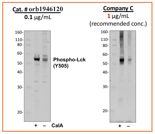 Phospho-Lck (Tyr505) rabbit mAb Antibody
