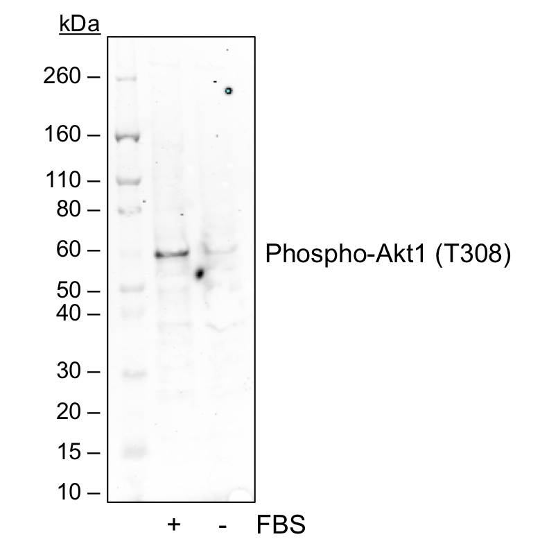Phospho-Akt1 (Thr308) rabbit mAb Antibody