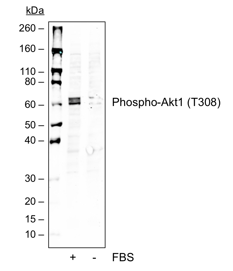 Phospho-Akt1 (Thr308) rabbit mAb Antibody