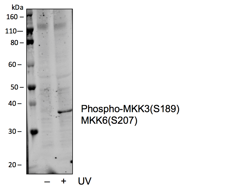 Phospho-MKK3 (Ser189)/MKK6 (Ser207) rabbit mAb Antibody