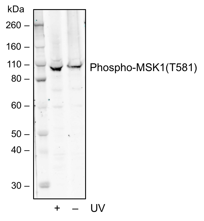 Phospho-MSK1 (Thr581) rabbit mAb Antibody
