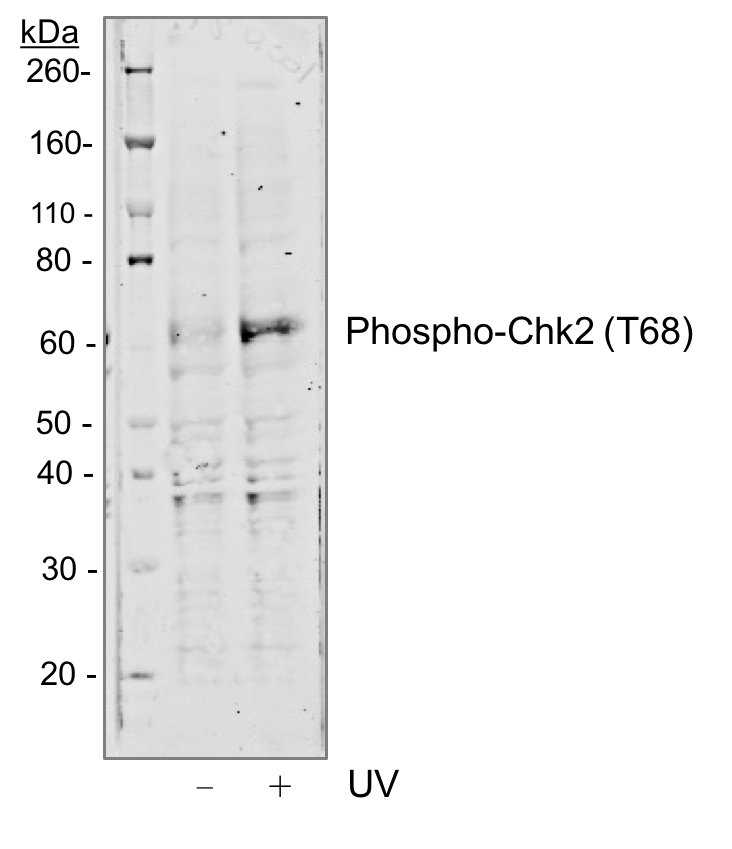 Phospho-Chk2 (Thr68) rabbit mAb Antibody
