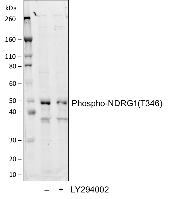 Phospho-NDRG1 (Thr346) rabbit mAb Antibody