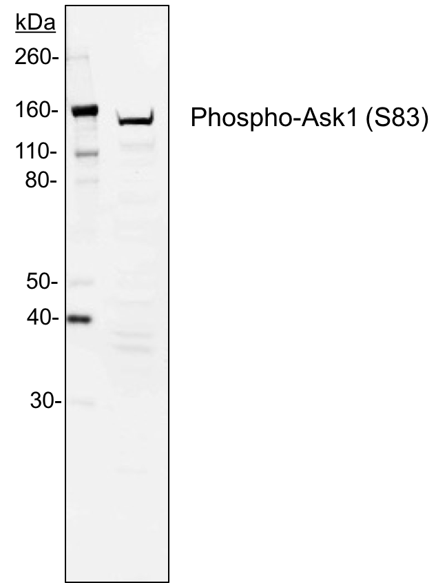 Phospho-Ask1 (Ser83) rabbit mAb Antibody