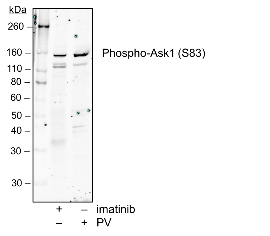 Phospho-Ask1 (Ser83) rabbit mAb Antibody