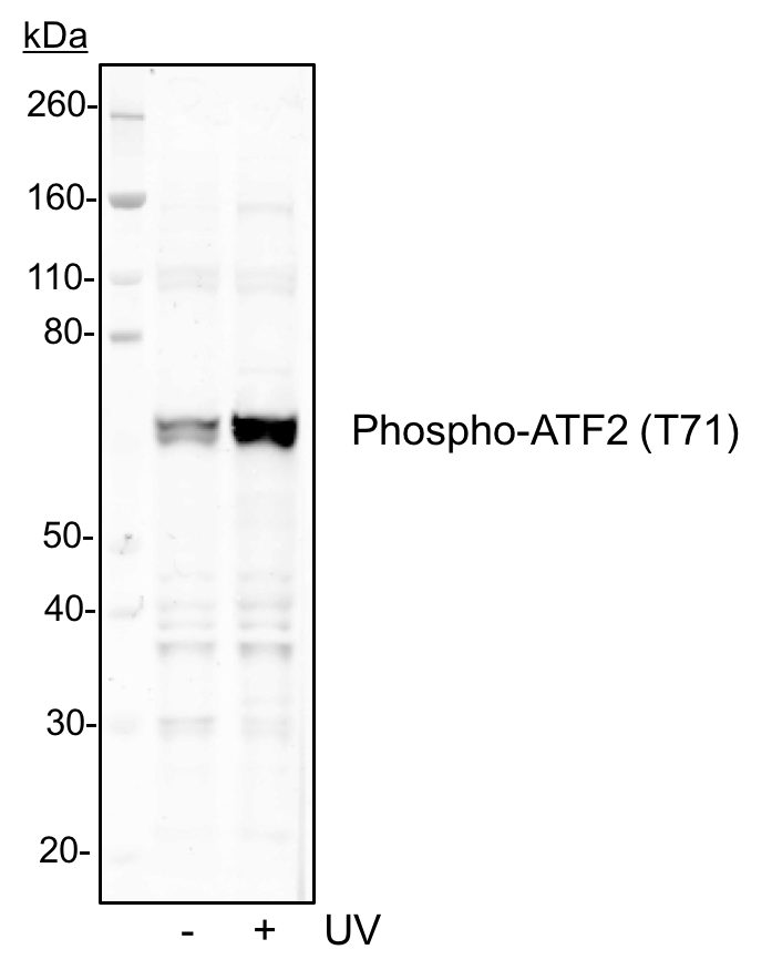 Phospho-ATF2 (Thr71) rabbit mAb Antibody