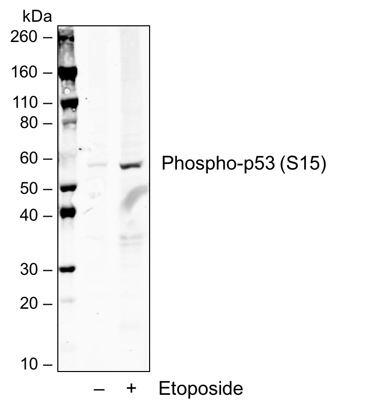 Phospho-p53 (Ser15) rabbit mAb Antibody