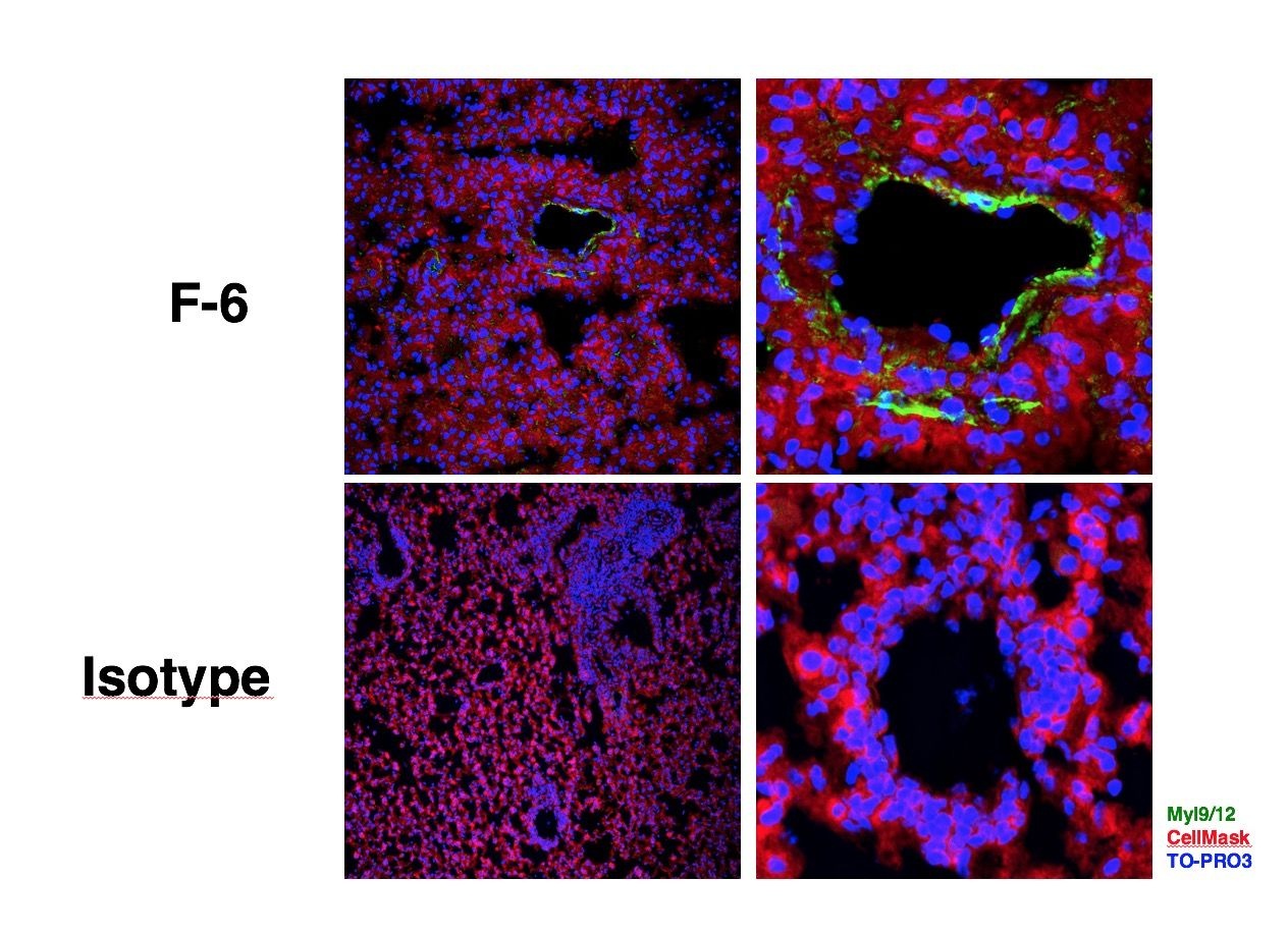 Human/Mouse Myl9/12 rabbit mAb Antibody