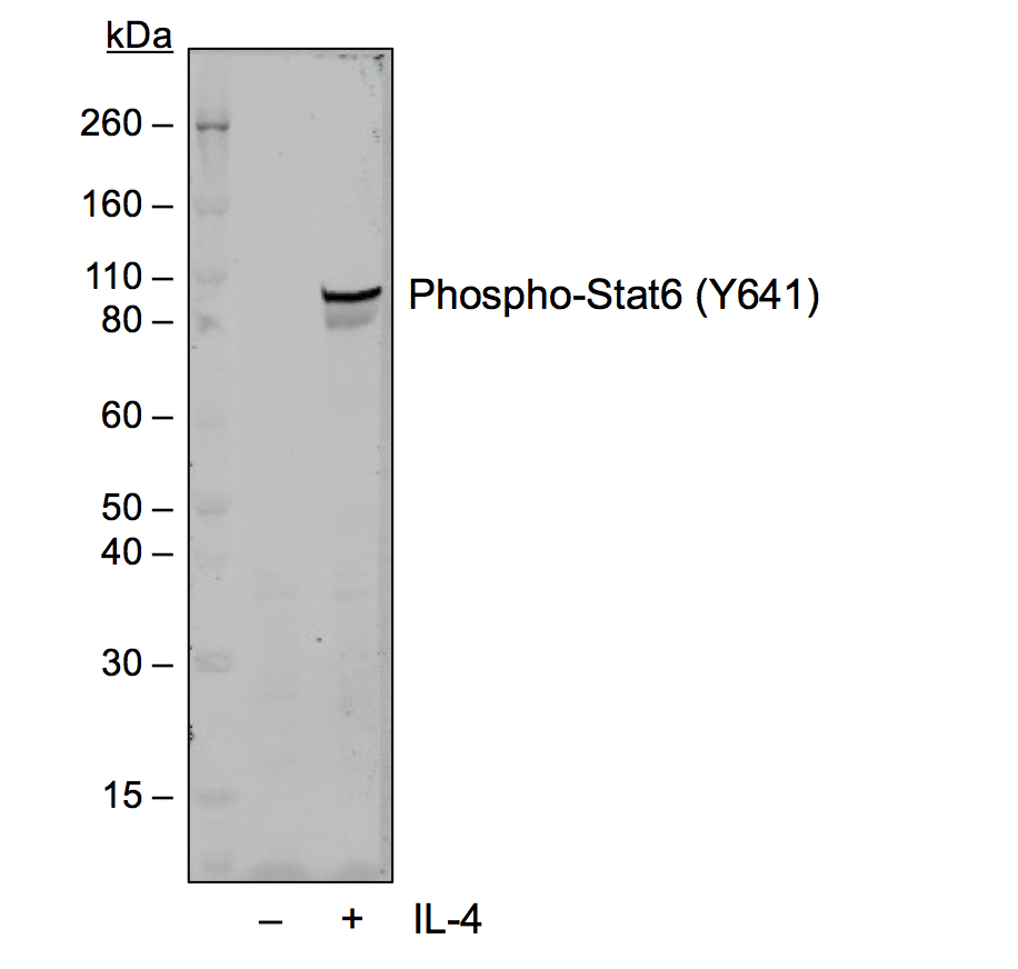 Phospho-Stat6 (Tyr641) rabbit mAb Antibody