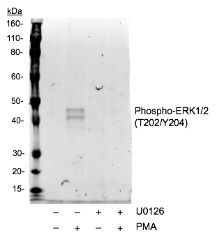 Phospho-p44/42 MAPK (Erk1/2) (Thr202/Tyr204) rabbit mAb Antibody