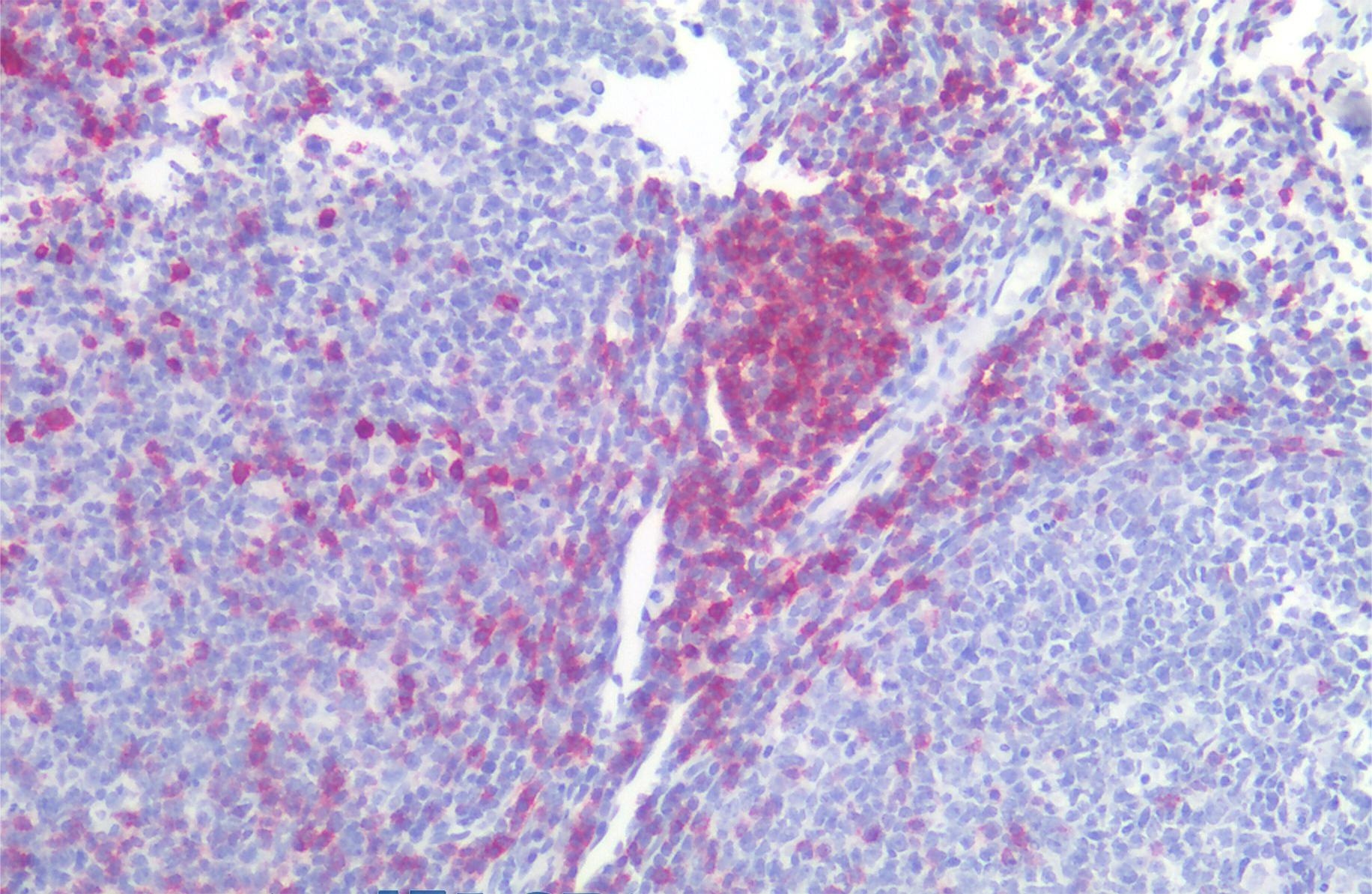 CD5 Antibody