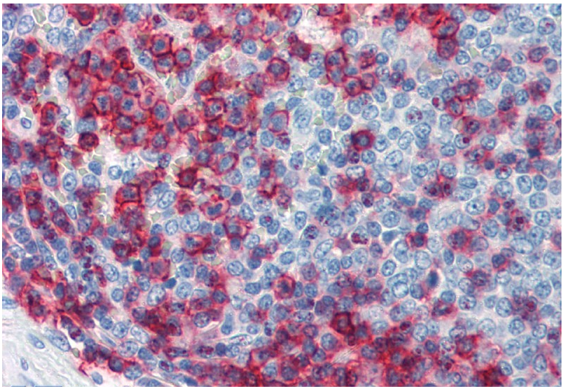 CD43 Antibody