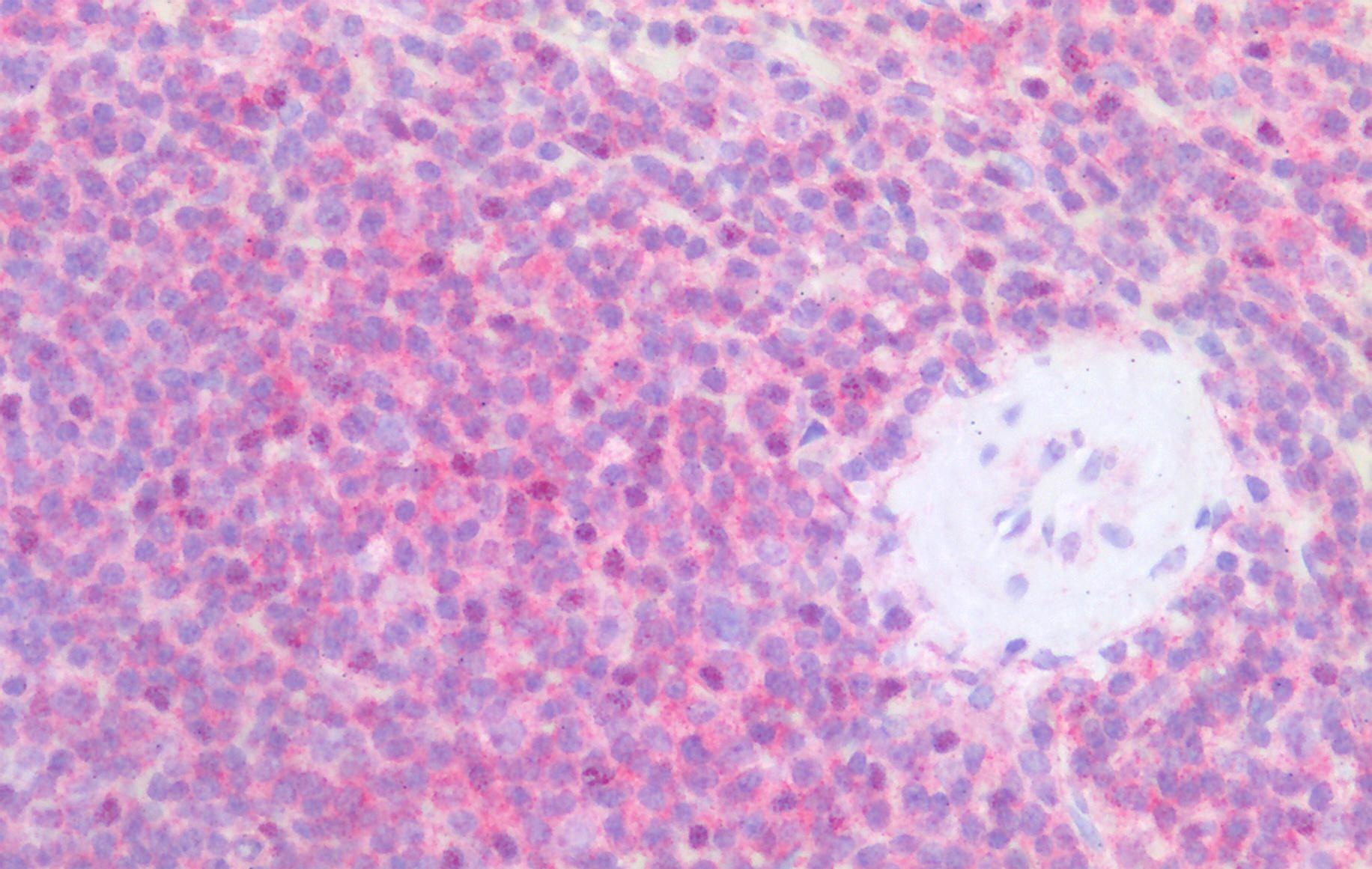 CD79b Antibody