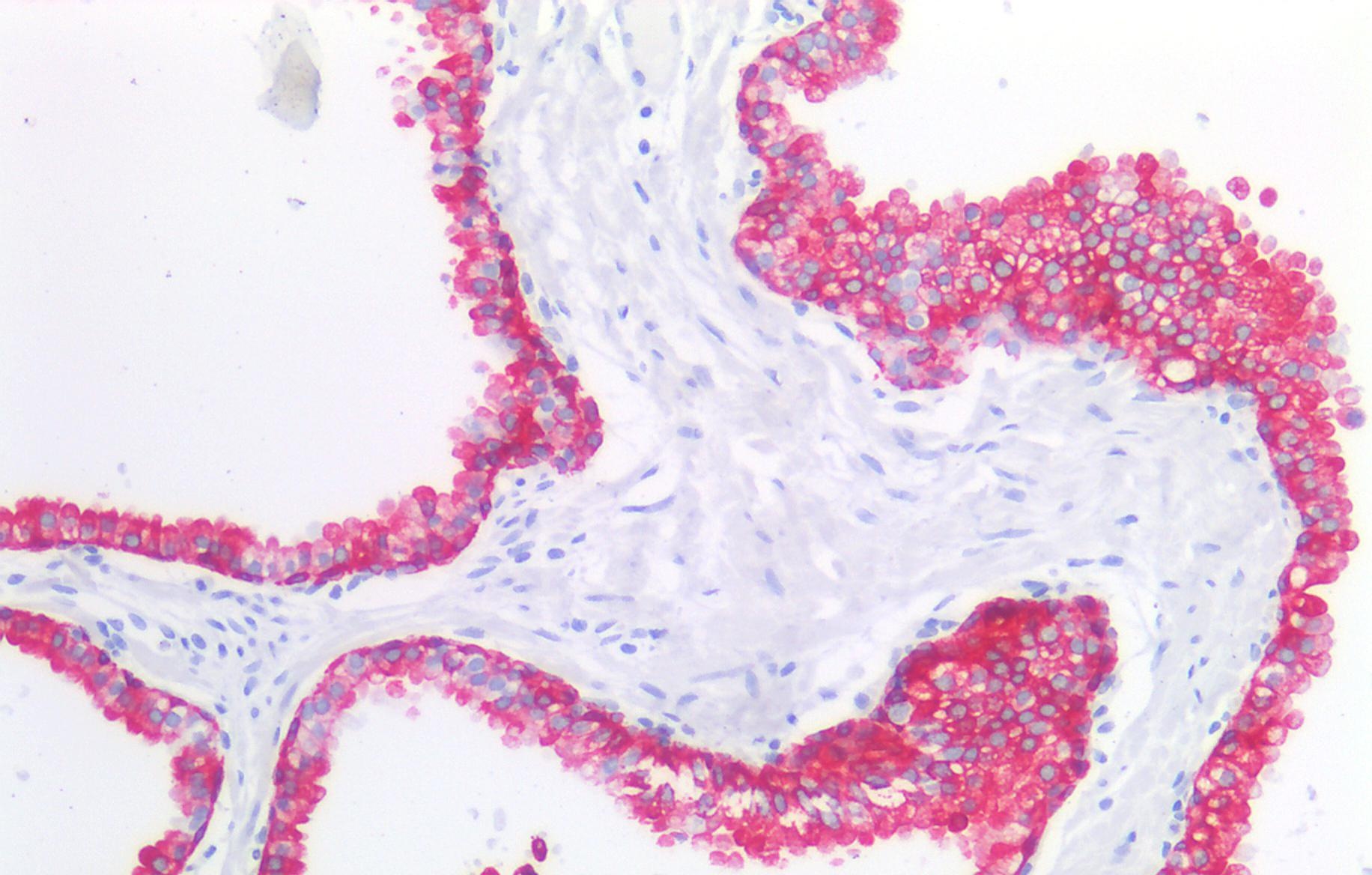 Cytokeratin 19 Antibody
