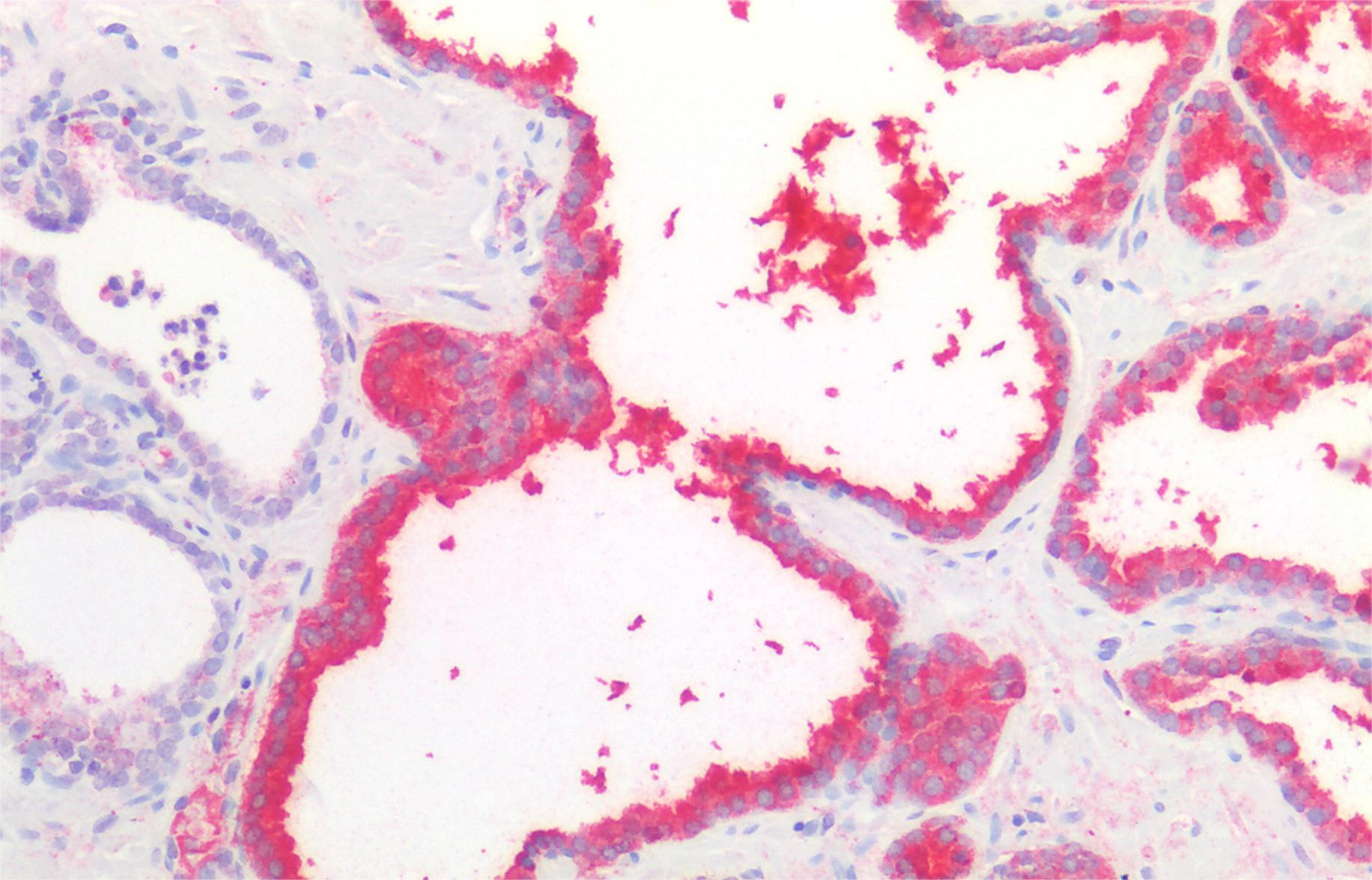 PSA Antibody