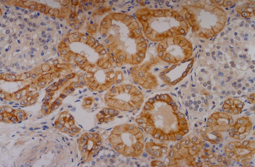Cytokeratin 18 Antibody