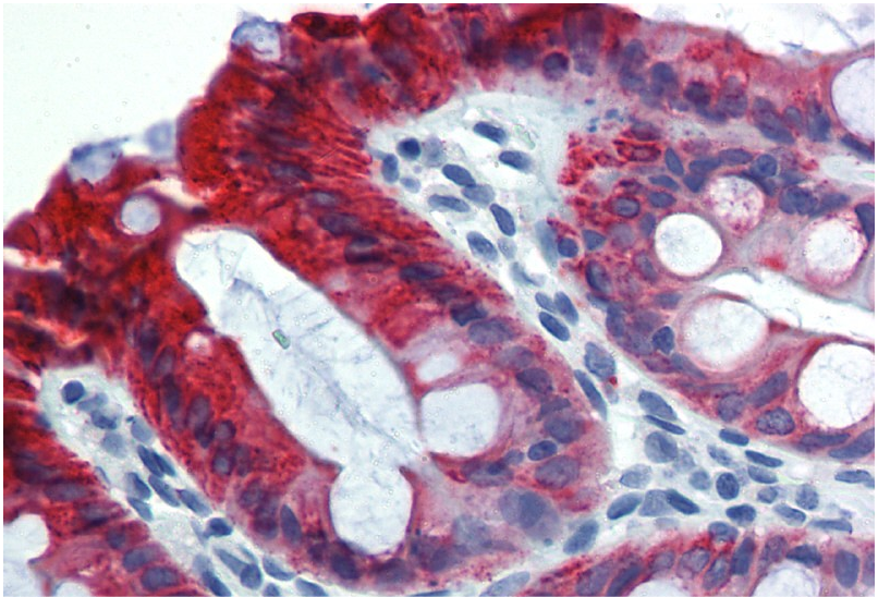 Cytokeratin 18 Antibody