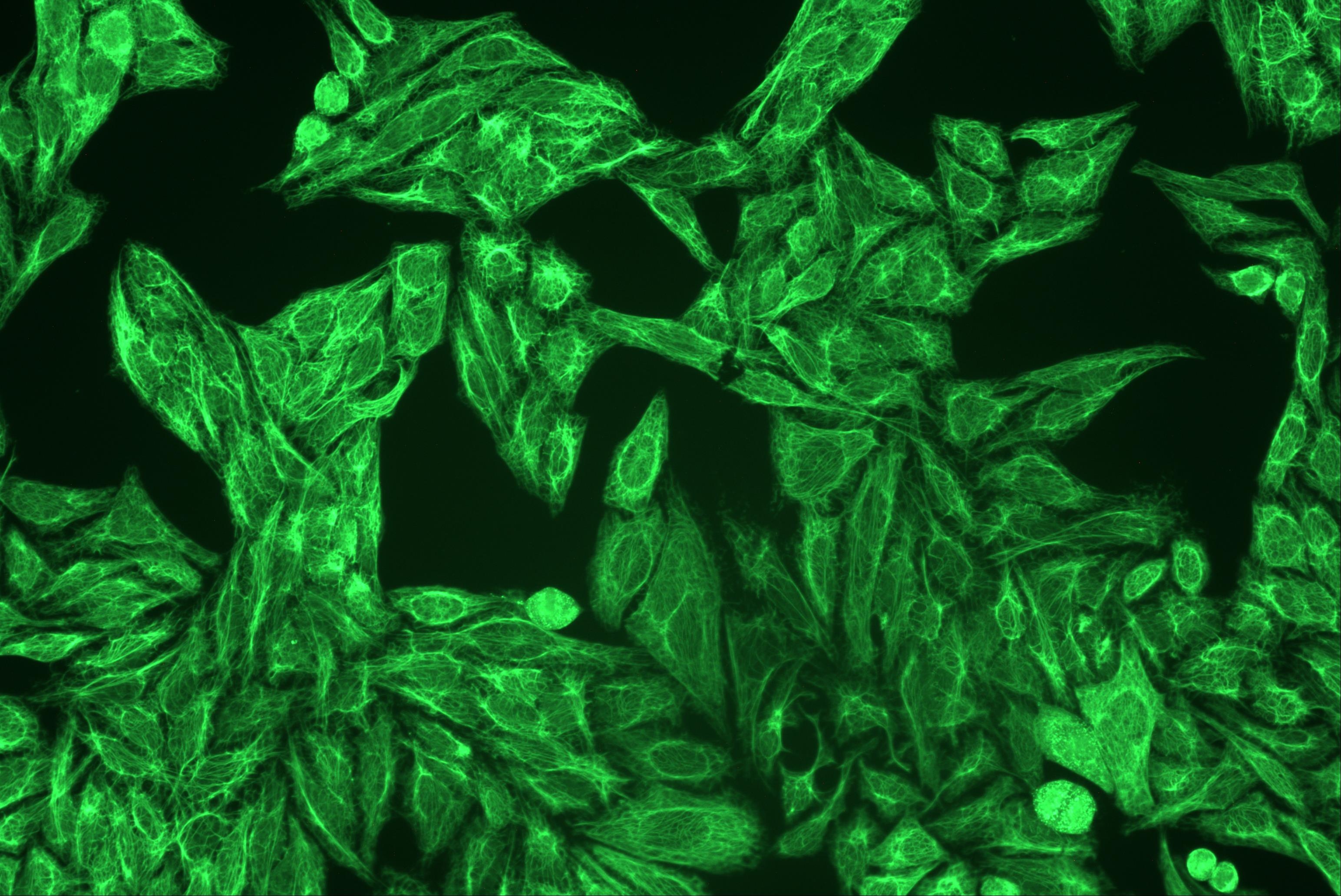 Cytokeratins Antibody