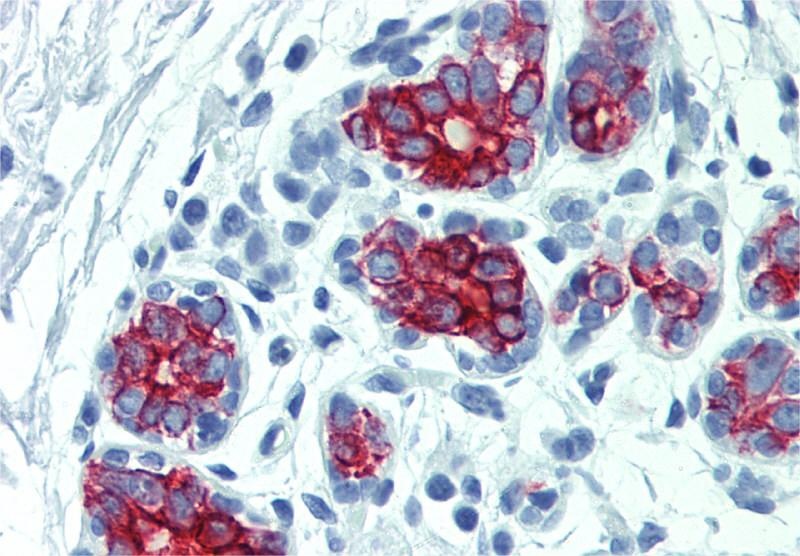 Cytokeratin 7/17 Antibody