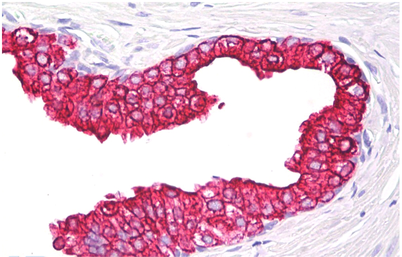 Cytokeratin 5/8 Antibody