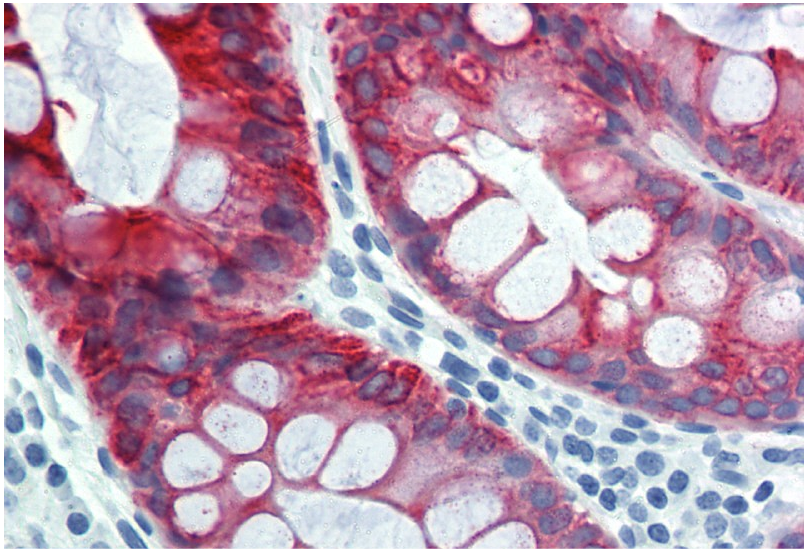 Cytokeratin 18 Antibody