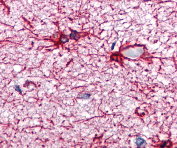 GFAP Antibody