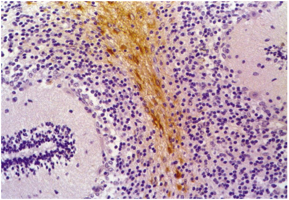 GFAP Antibody