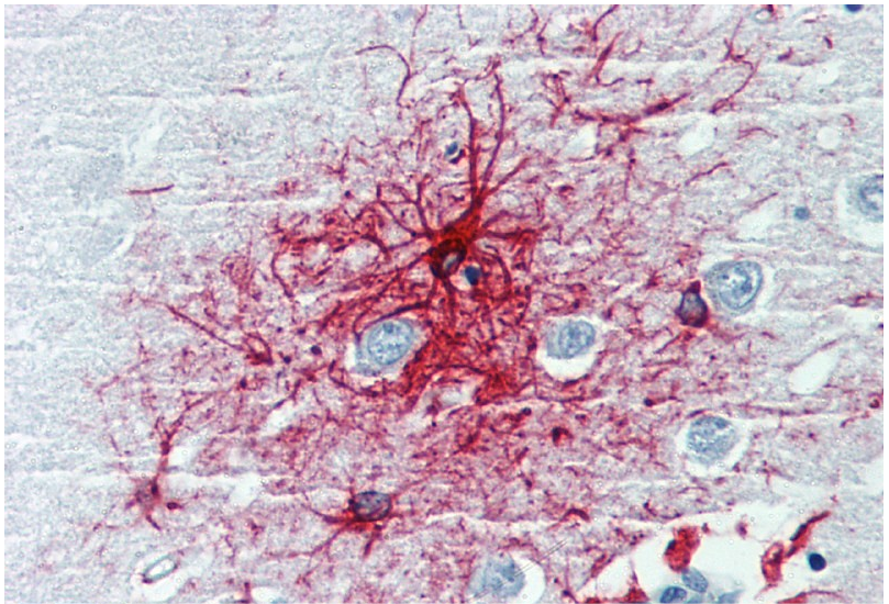 GFAP Antibody