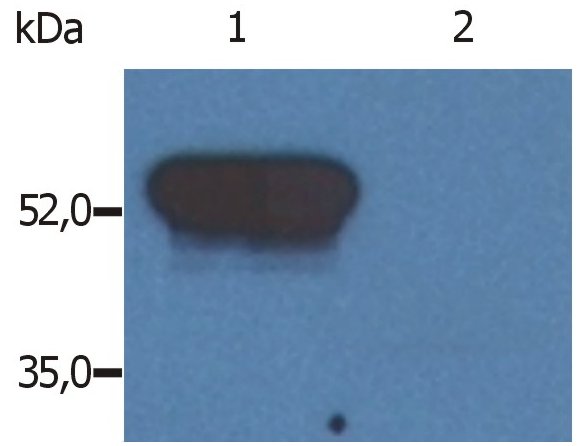 GFAP Antibody