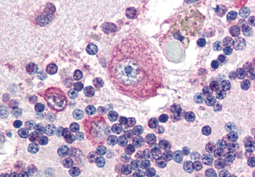 Placental Alkaline Phosphatase Antibody