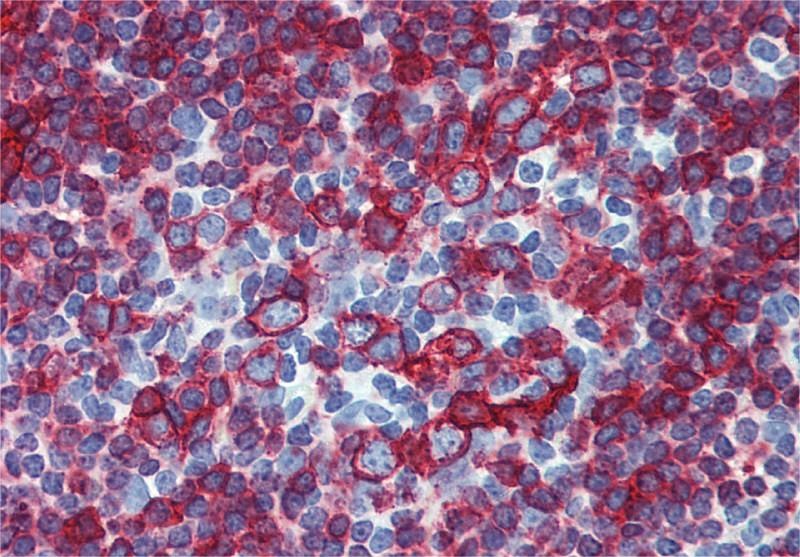 HLA-DR/DP Antibody