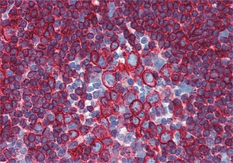 HLA-DR/DP Antibody