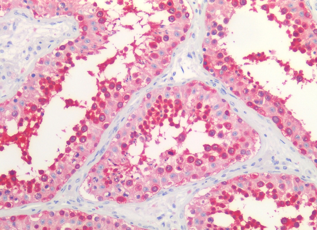 HSP90 alpha/beta Antibody