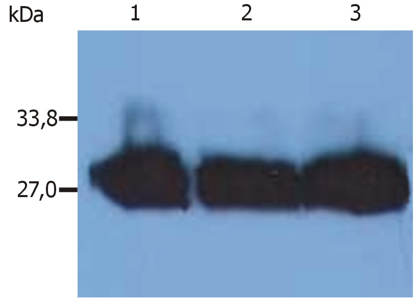 Ig Kappa Light Chain Antibody