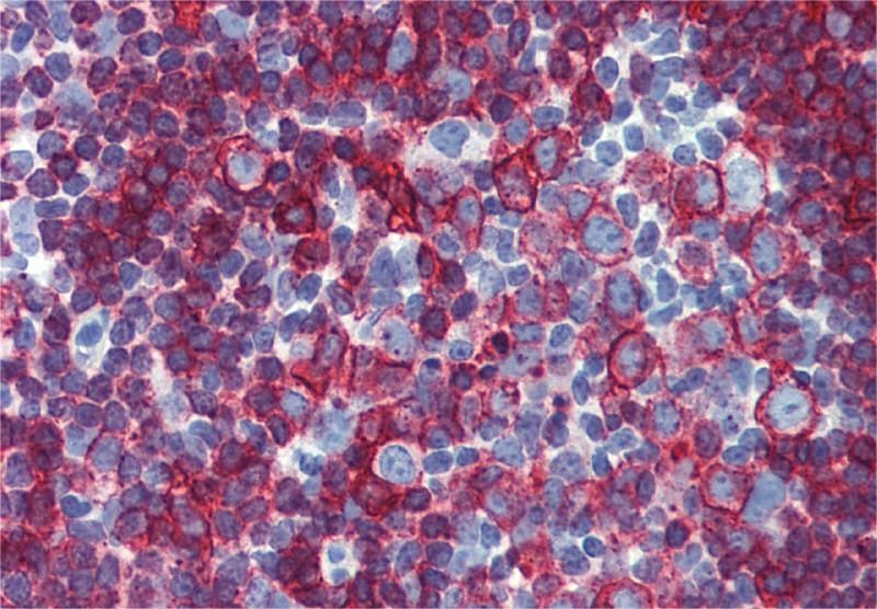HLA-DR/DP Antibody