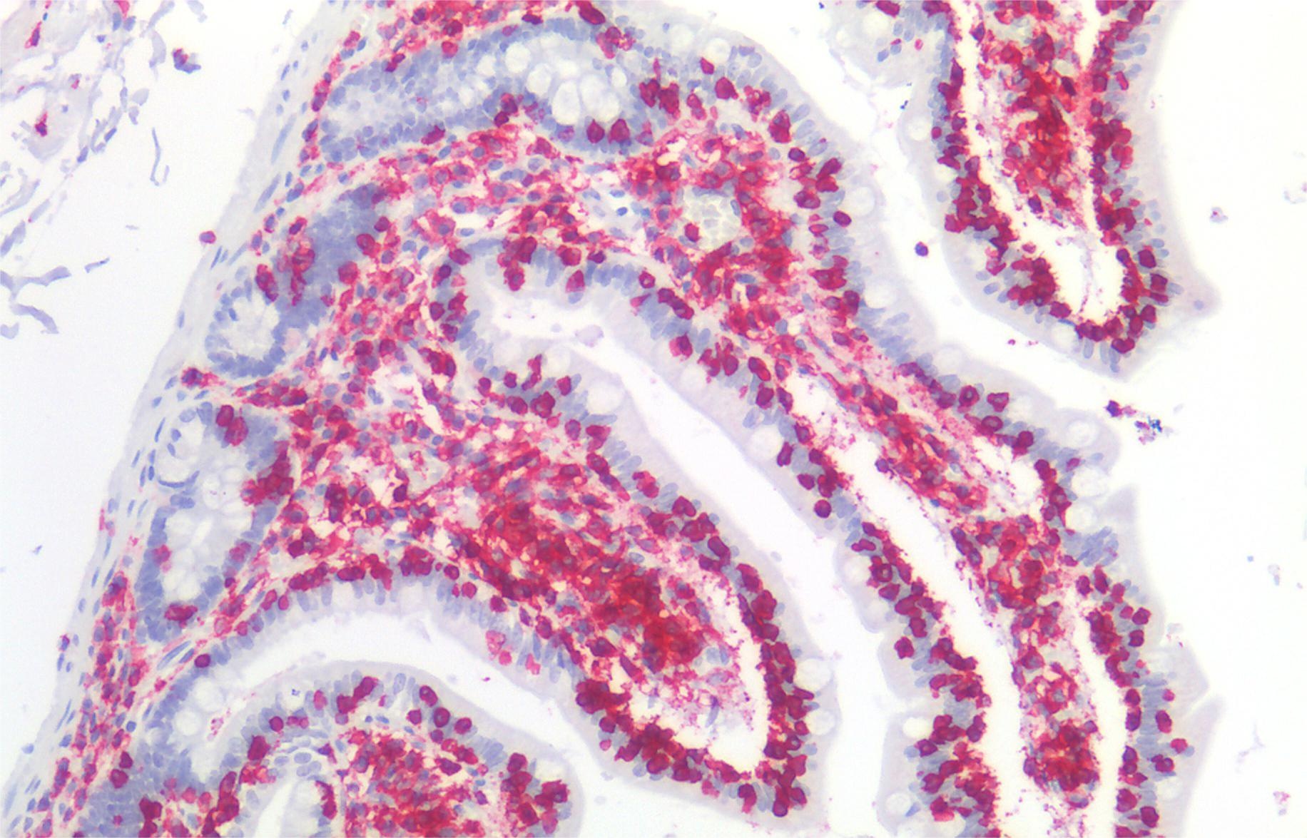 CD45 Antibody