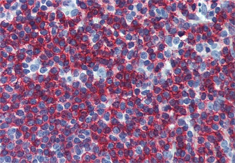 CD45RB Antibody
