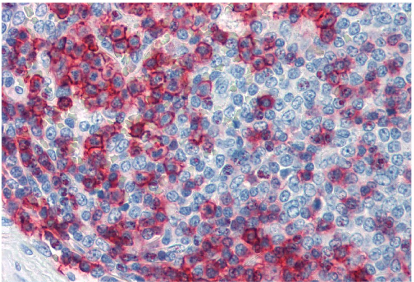 CD43 Antibody